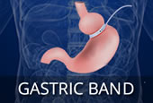 Darebin-weight-loss-surgery-gastric-band